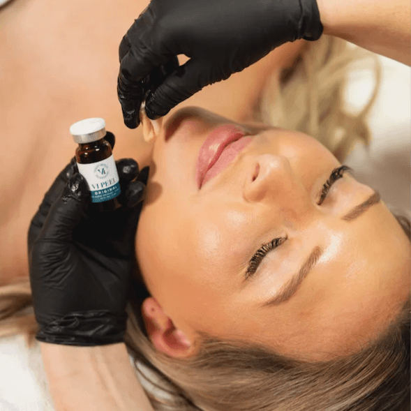 VI Peel Precision Plus Package of 3 at Skinology Aesthetics in West Caldwell, NJ
